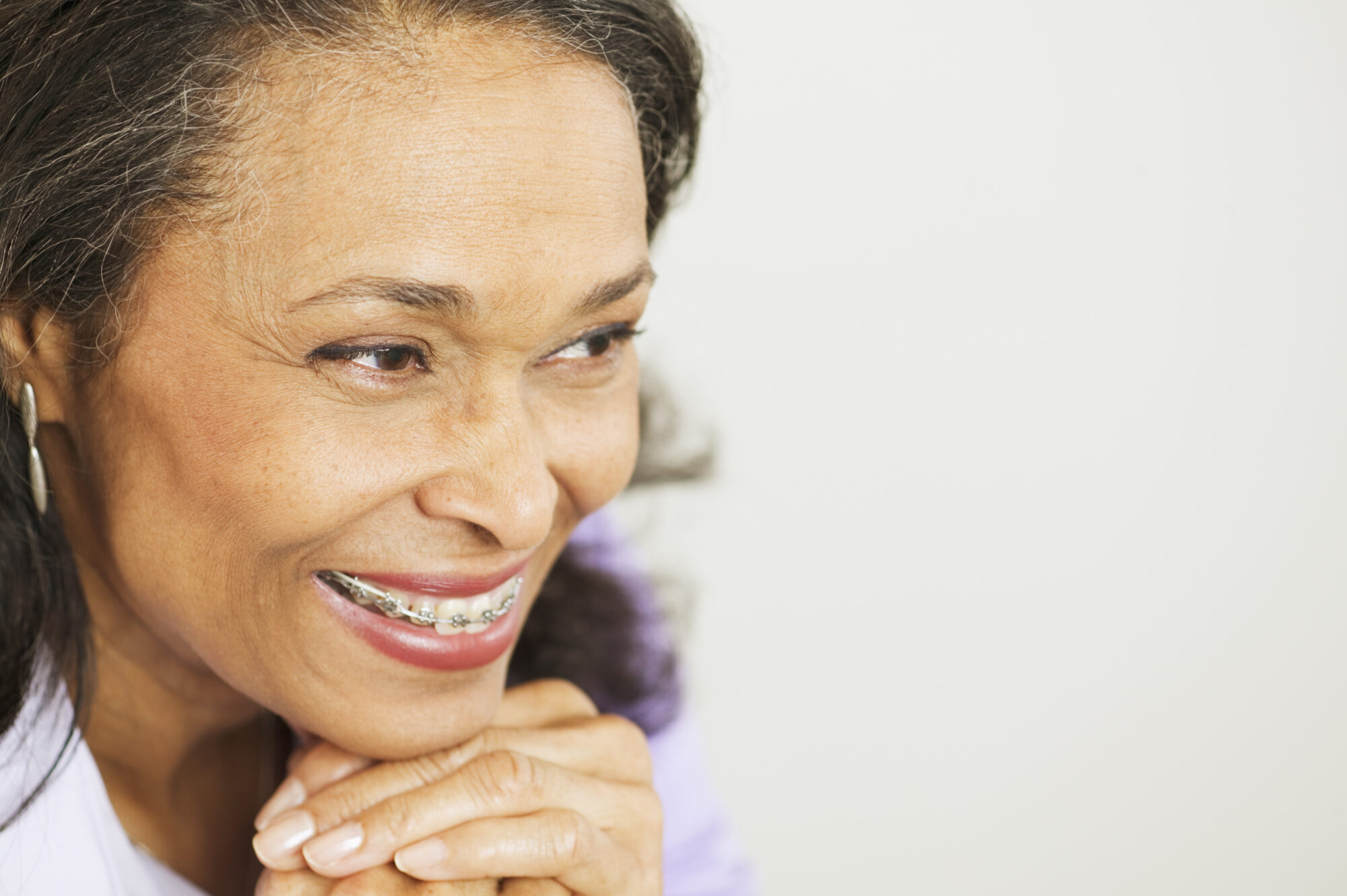 Most Discreet Orthodontic Options for Adults?